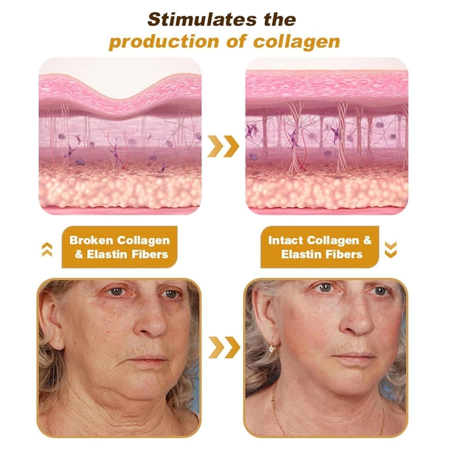 BeeTox™ - Bee Venom Wrinkle Repair Cream 🐝✨ (Buy 1 Get 1 Free 🔥🔥)